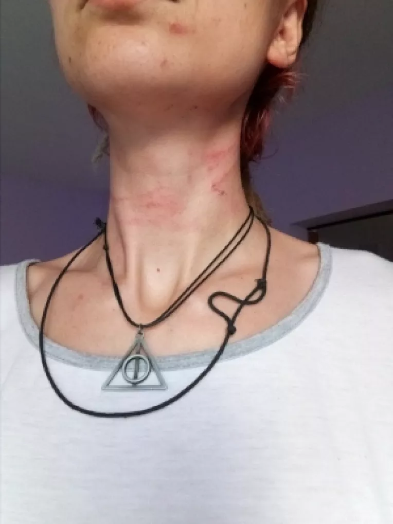 Drama unei cantarete de 23 de ani batuta crunt de sotul ei la doua saptamani dupa ce s-au casatorit